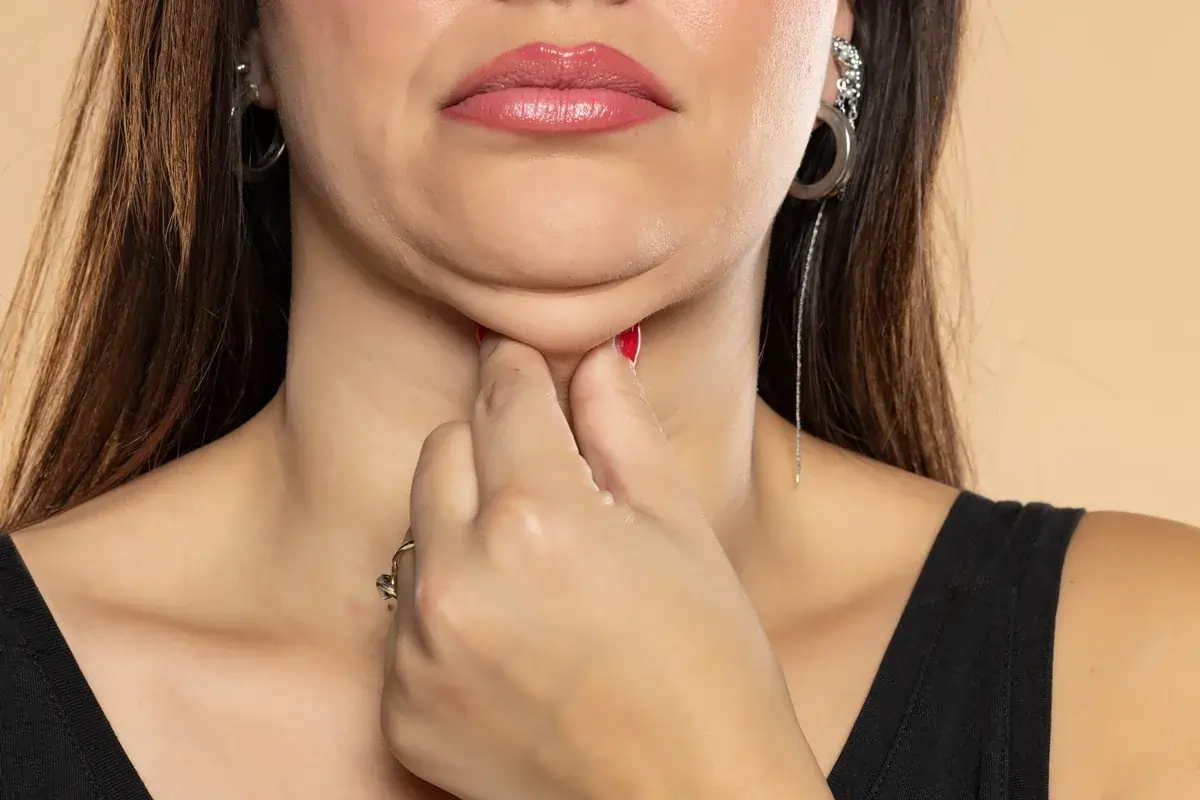 Double Chin Treatment targeting excess fat beneath the chin and improving jawline definition